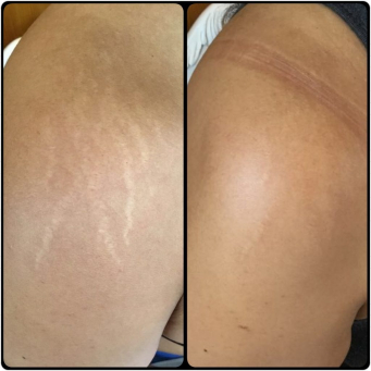 Laser and Skin Clinic